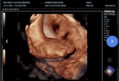 11 days late -BFN! Please someone give me a success story.