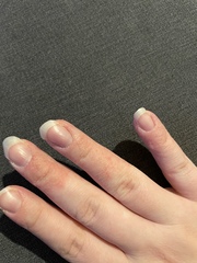 Any dermatologists? I’m at my wits end!