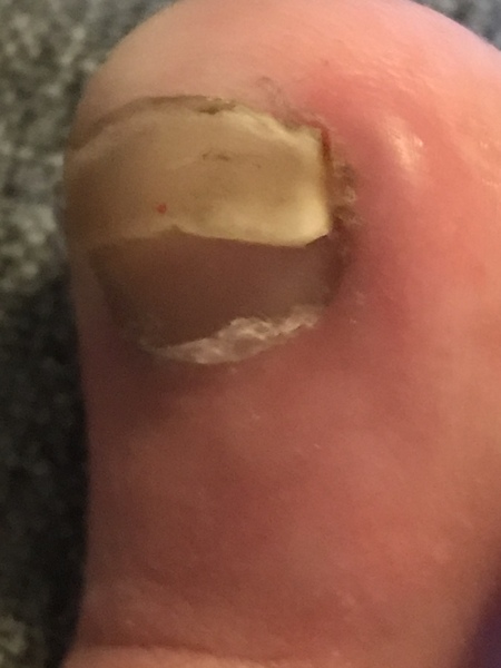 What’s wrong with my toenail??