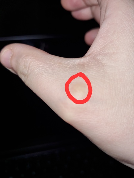 Would you go to GP over this mark on hand?