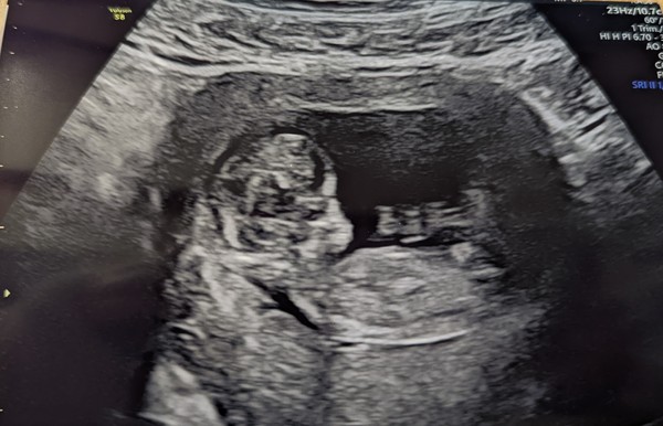 Due July/August (vol. 2)