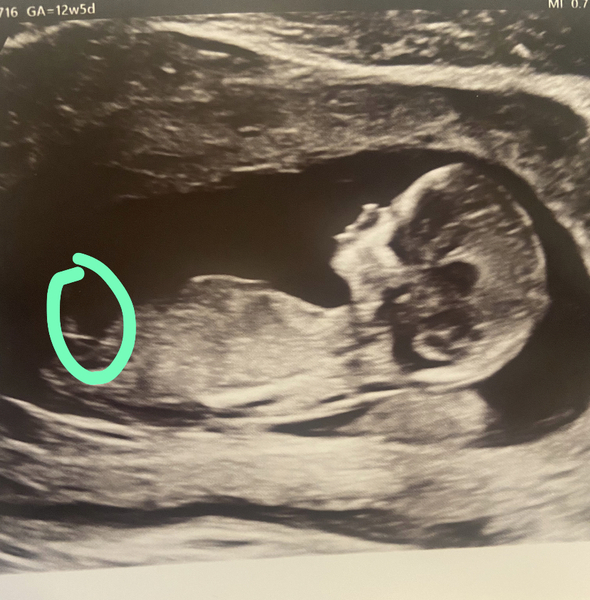 Without telling me what the sex is, is it obvious from my scan?