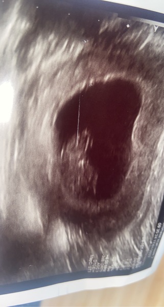 Due August 2022