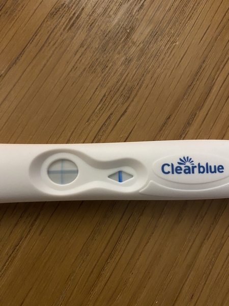 Post IVF line eyes