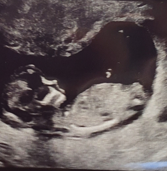 Gender guesses?? I can't spot a nub!!