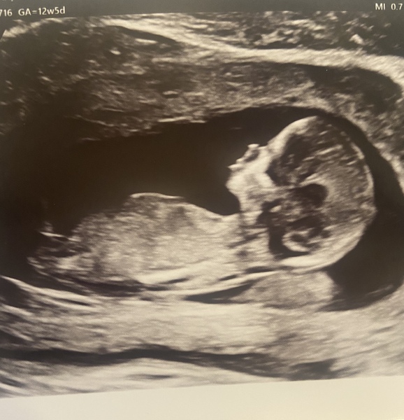 Due August 2022 ☀️