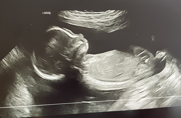 Due June 2022 (thread six)