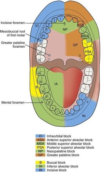 Root canal question? Any help greatly appreciated
