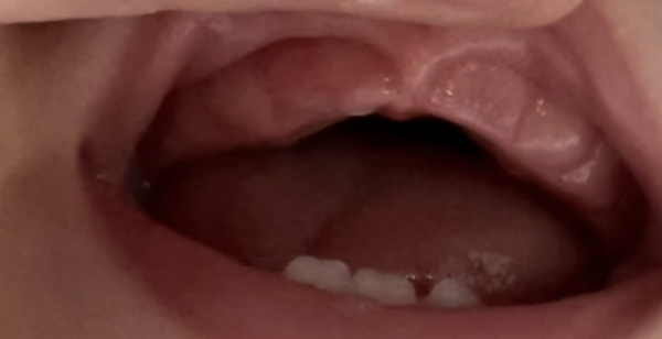 How early do babies teethe?how do i know it's happening?