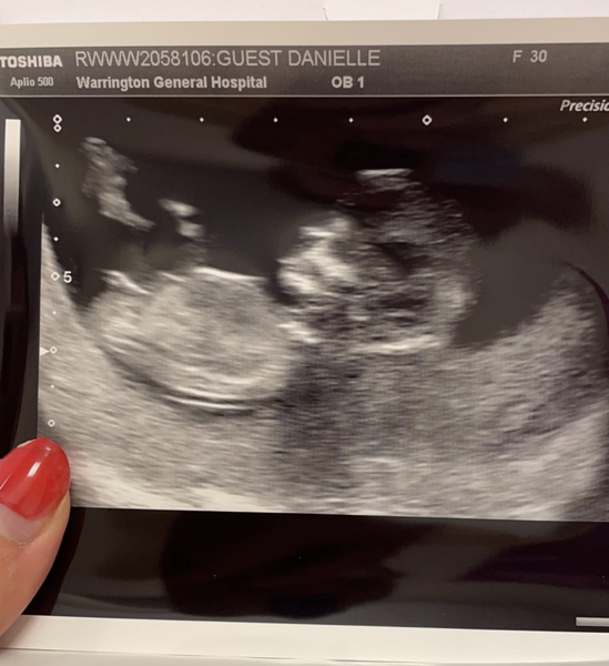 Gender Guesses?