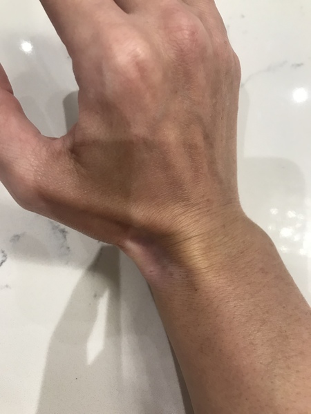 What the hell has happened to my wrist??!!
