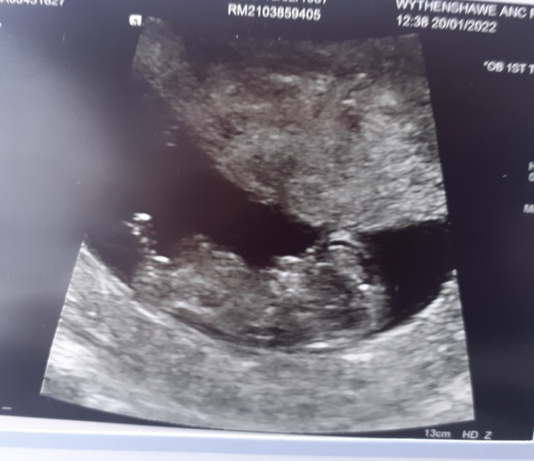 Boy or girl ???