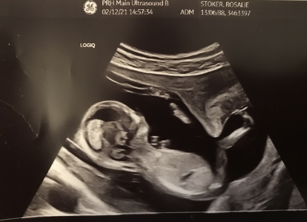 12wk scan gender guesses!