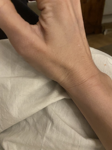 What the hell has happened to my wrist??!!