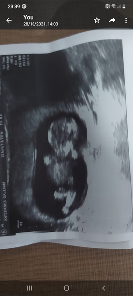 Skull theory anyone? Pics included