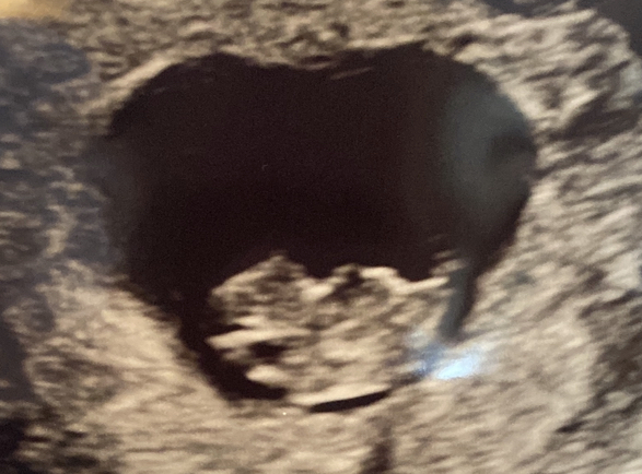 Due August 2022