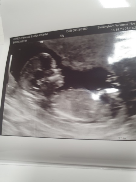 Due July 2022 (thread 3)