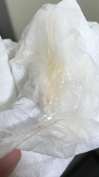 Please can someone tell me what this might be? **MNHQ adding content warning for somewhat graphic image**