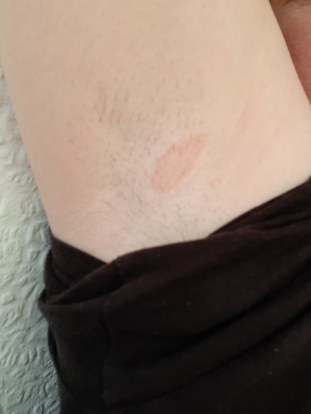 WTF is this? Dr Google has no answers.  PHOTOS!!
