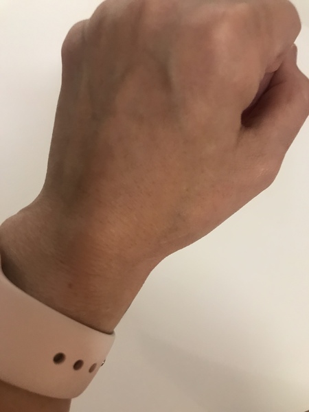 What the hell has happened to my wrist??!!
