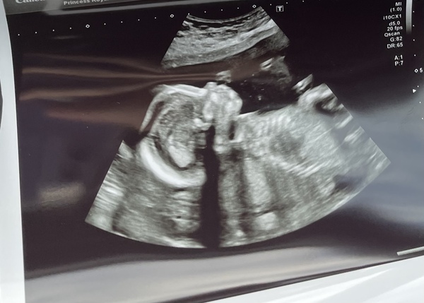 Due June 2022 (thread six)