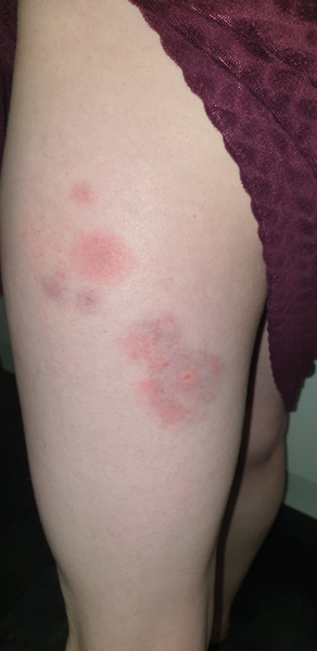 DDs leg - please have a look!