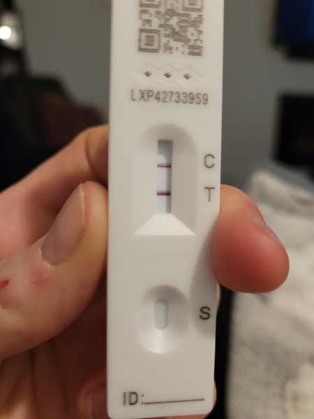 When did your symptoms peak?