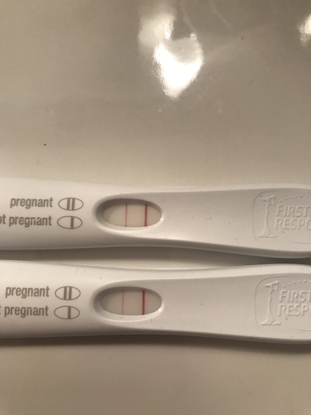 Post IVF line eyes