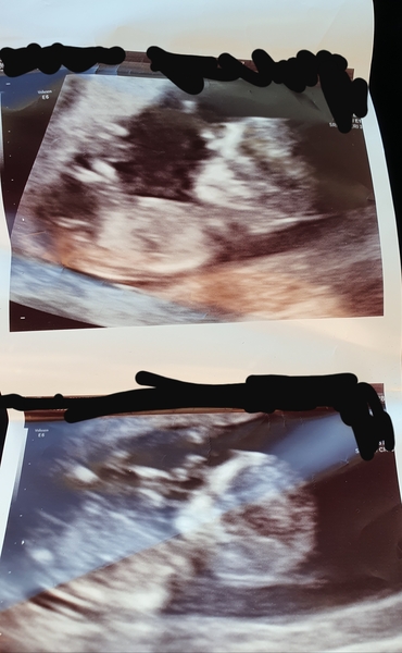 Scan sex guesses! Nub/ skull