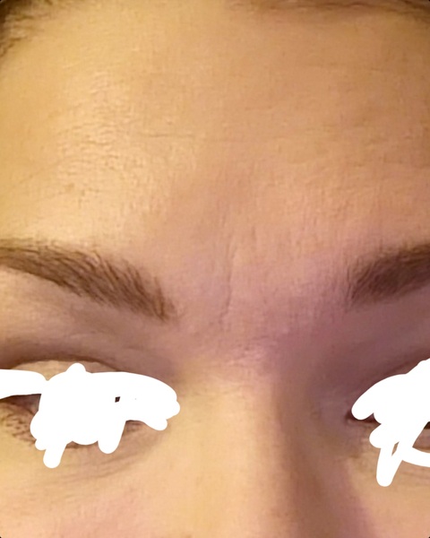 Is my skin that bad ?  Picture.