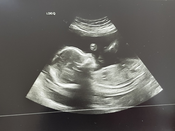 Due June 2022 (thread six)
