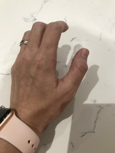 What the hell has happened to my wrist??!!