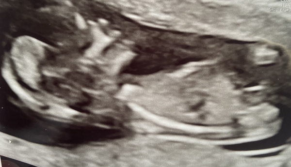 Updated: nub theory