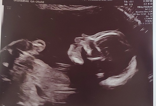 Due June 2022 (thread six)
