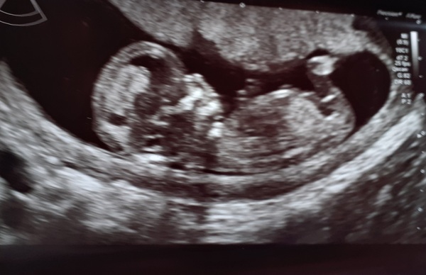 Sex predictions please