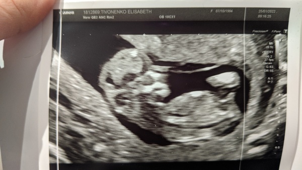 Due August 2022 ☀️