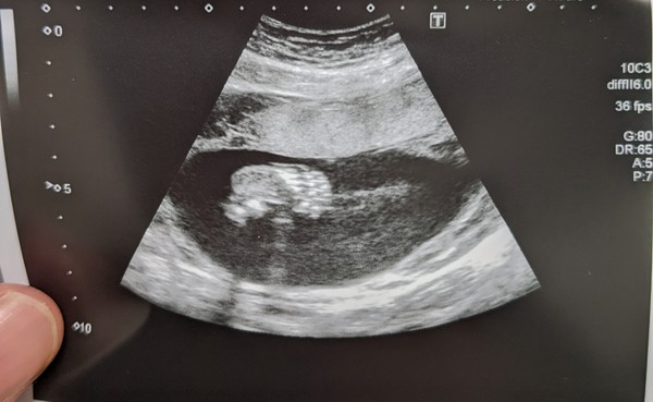 Due June 2022 (thread seven!)