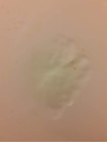 To ask what this is? (Pics included)