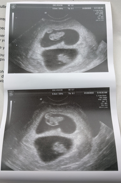 Due August 2022 ☀️