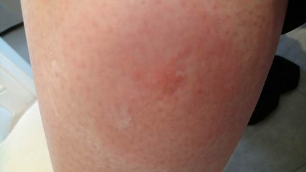 What was this bite? Posting for traffic