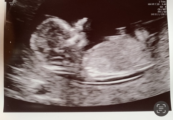 Nub theory - 13 weeks