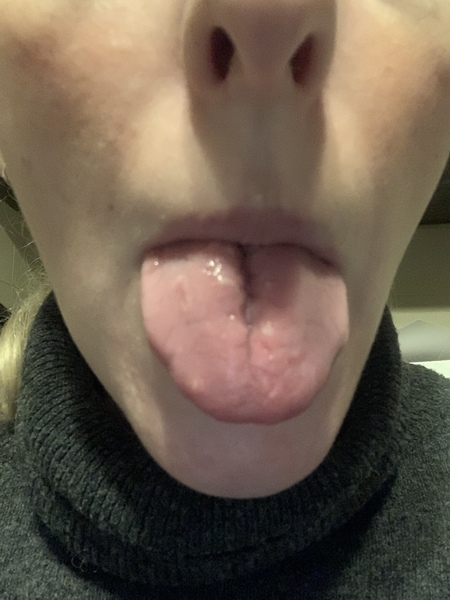 What the hell is happening to my tongue?