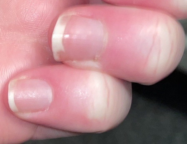 strange nails??