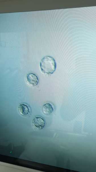 Does anyone know if one of my frozen embryos is a morula? (Pic attached)