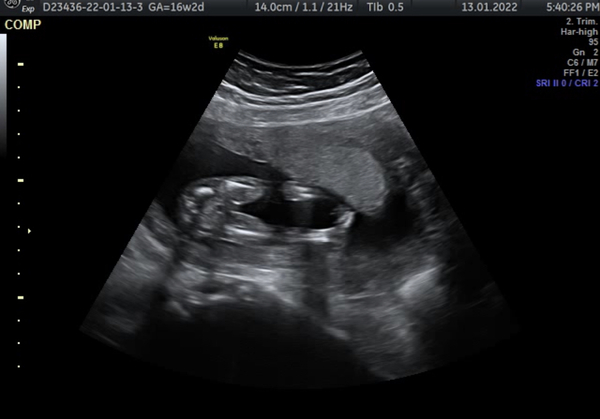 16 week gender scan confusion! Help!