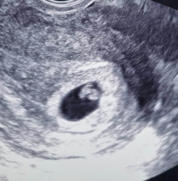 Ultrasound Advice