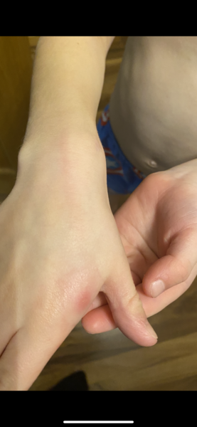 Does this need an antibiotic?
