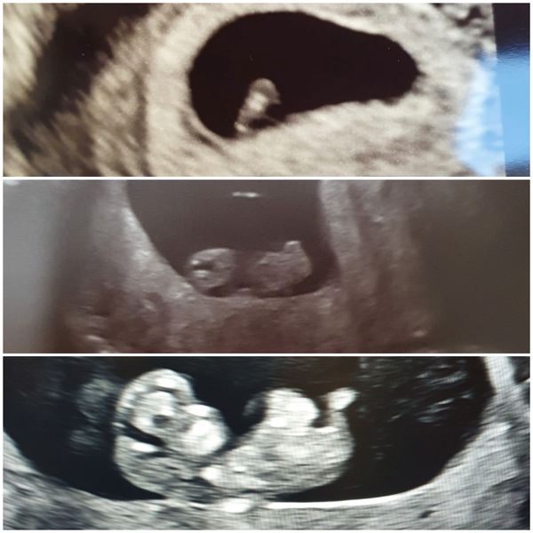 Due August 2022