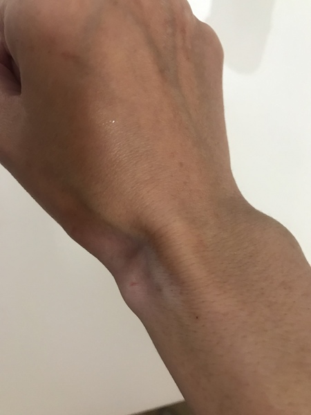 What the hell has happened to my wrist??!!