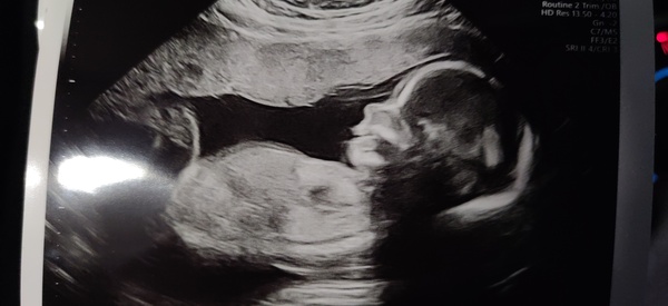 Due June 2022 (thread six)
